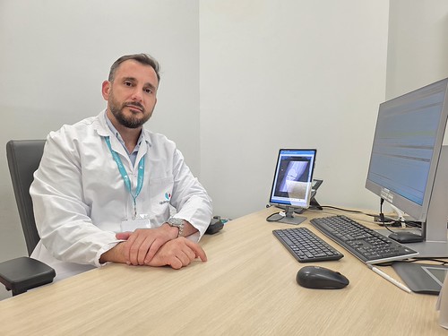 El robot ROSA permite realizar cirugías de prótesis articular con precisión milimétrica y mayor seguridad para el paciente El robot ROSA permite realizar cirugías de prótesis articular con precisión milimétrica y mayor seguridad para el paciente