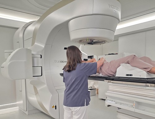 La hipertermia oncológica mejora los efectos de la radioterapia sobre el cáncer de mama La hipertermia oncológica mejora los efectos de la radioterapia sobre el cáncer de mama